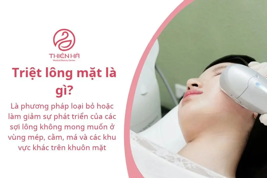 Triệt lông mặt là gì?