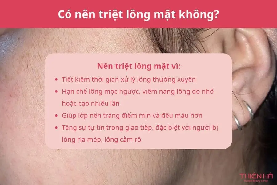 Có nên triệt lông mặt không?