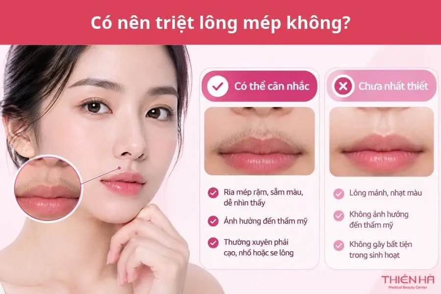 Có nên triệt lông mép không?
