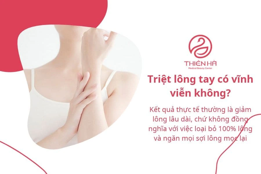 Triệt lông tay vĩnh viễn có thực sự hiệu quả không? 1 Triệt lông tay có vĩnh viễn không?