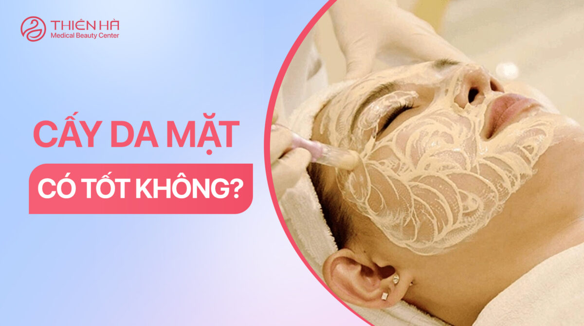 Cấy trắng da mặt có tốt không và những điều bạn cần biết