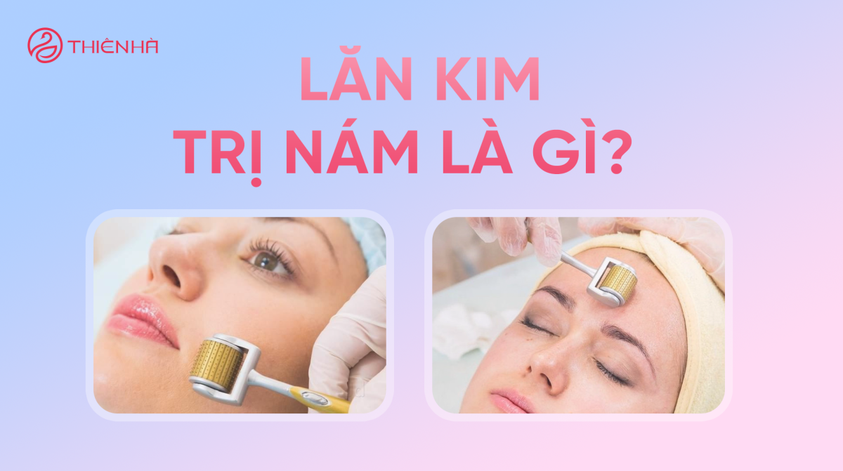 Lăn kim trị nám là gì? Lợi ích, rủi ro và cách chăm sóc