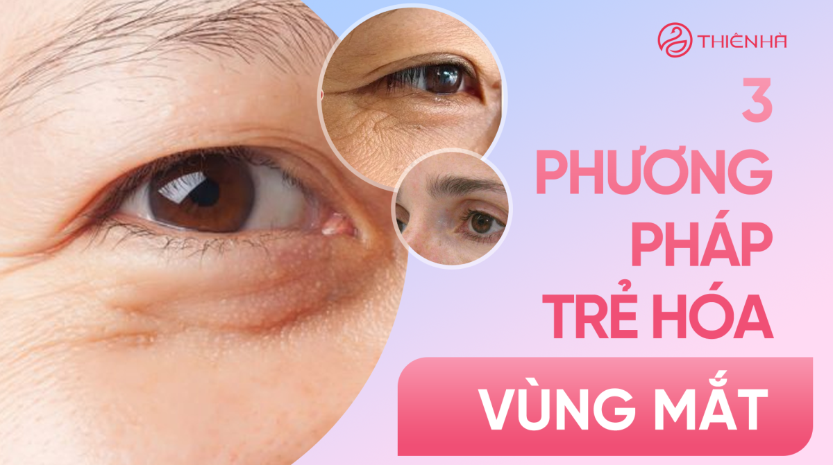 3 phương pháp trẻ hóa vùng mắt được áp dụng nhiều nhất