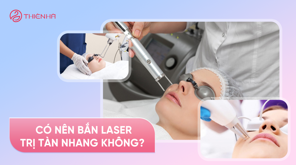 Có nên bắn laser trị tàn nhang không? Giải đáp từ chuyên gia