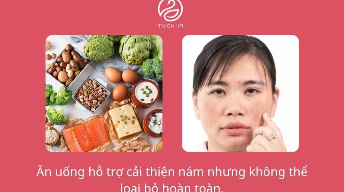 Ăn gì trị nám da mặt? Gợi ý thực phẩm giúp da sáng khỏe