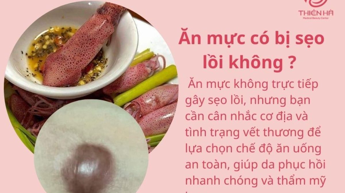 Ăn mực có bị sẹo lồi không? Chuyên gia da liễu giải đáp chi tiết