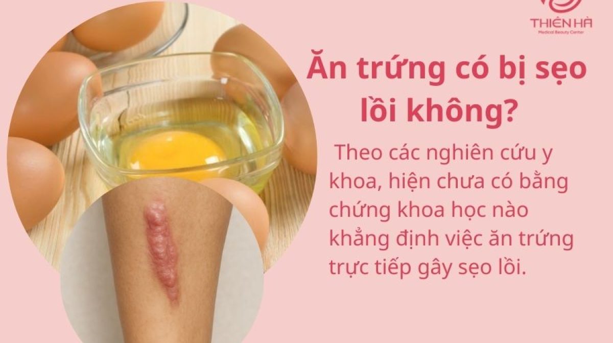 Ăn trứng có bị sẹo lồi không? Sự thật khoa học & lời khuyên từ bác sĩ