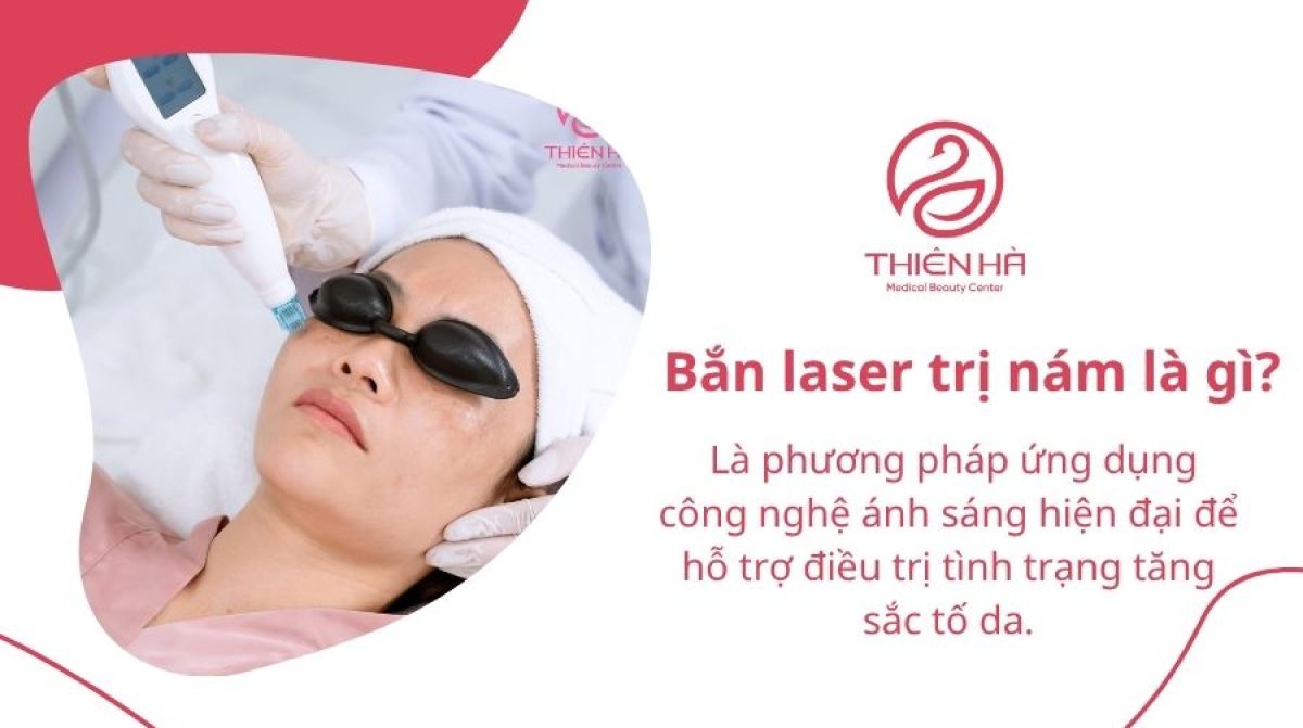 Bắn laser trị nám là gì? Hiệu quả, chi phí và lưu ý quan trọng