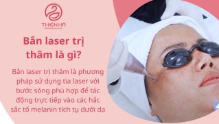 Bắn laser trị thâm: Giải pháp hiệu quả giúp da sáng mịn