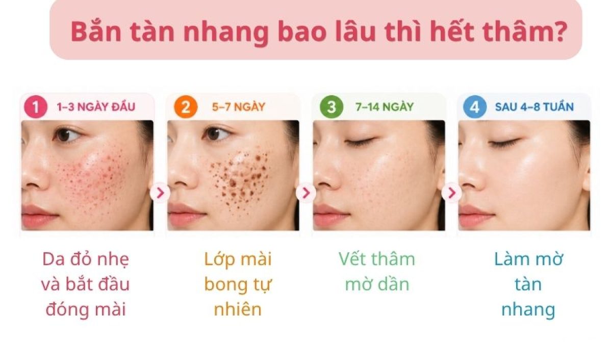 Bắn tàn nhang bao lâu thì hết thâm? Timeline phục hồi da