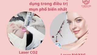Bắn Tia Laser Trị Mụn: Hiệu Quả, Ưu Nhược Điểm & Chi Phí