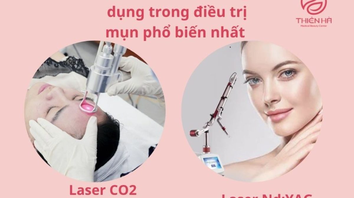 Bắn Tia Laser Trị Mụn: Hiệu Quả, Ưu Nhược Điểm & Chi Phí