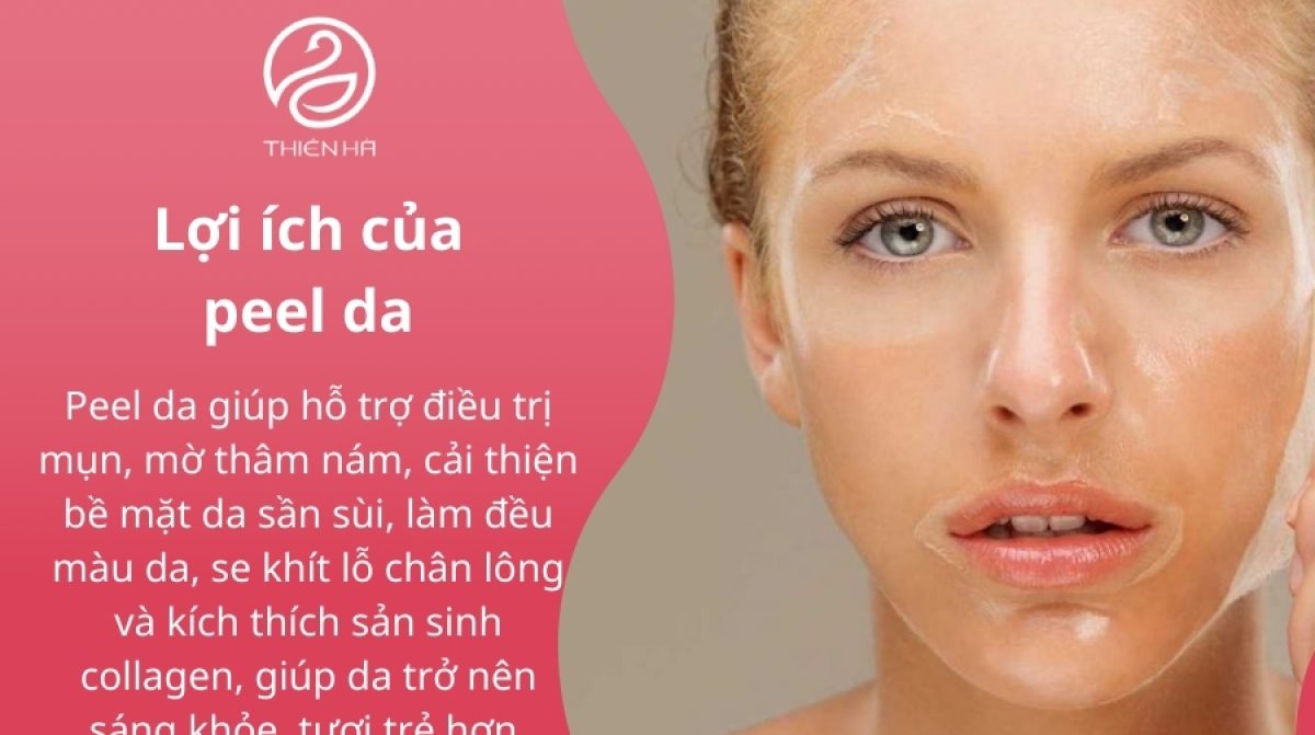 Peel da bao lâu 1 lần? Lời khuyên từ chuyên gia Thiên Hà
