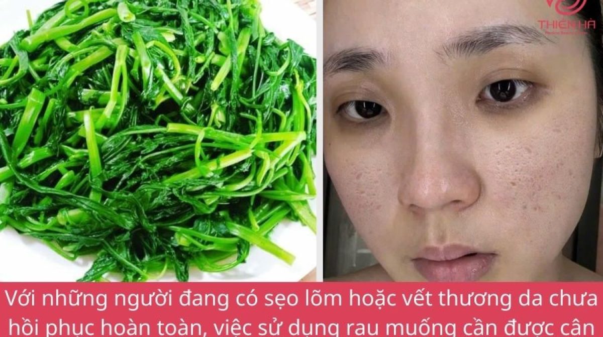 Bị sẹo lõm có nên ăn rau muống không ? Lời khuyên cho người bị sẹo lõm