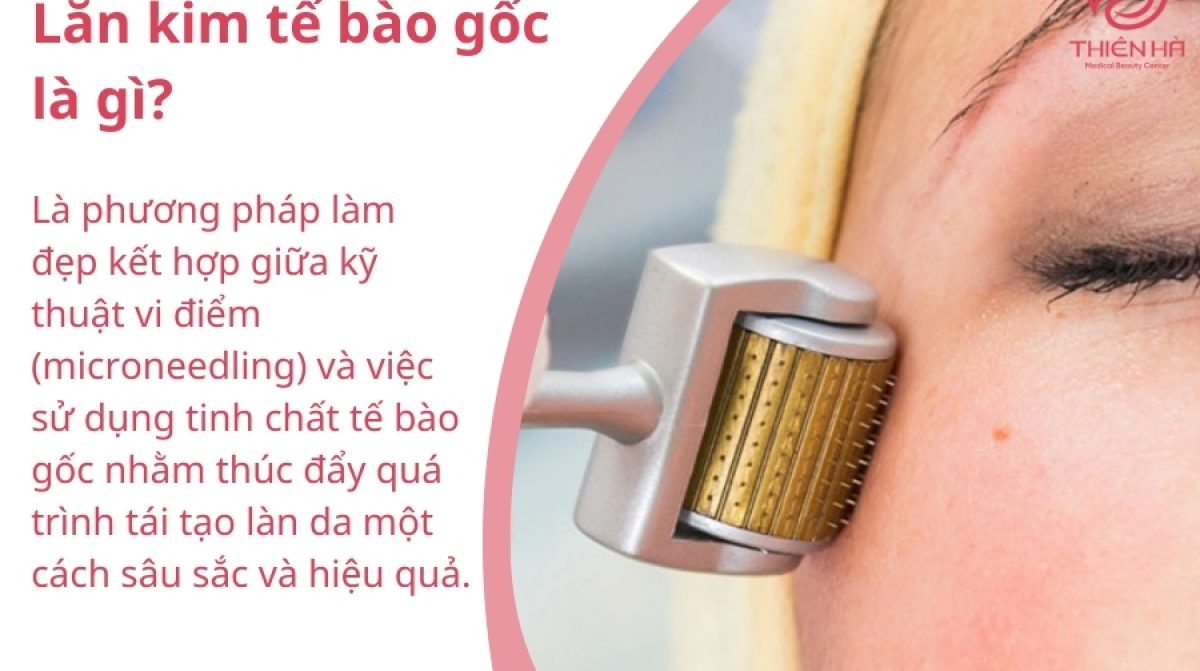 Lăn kim tế bào gốc: Lợi ích, quy trình & lưu ý quan trọng