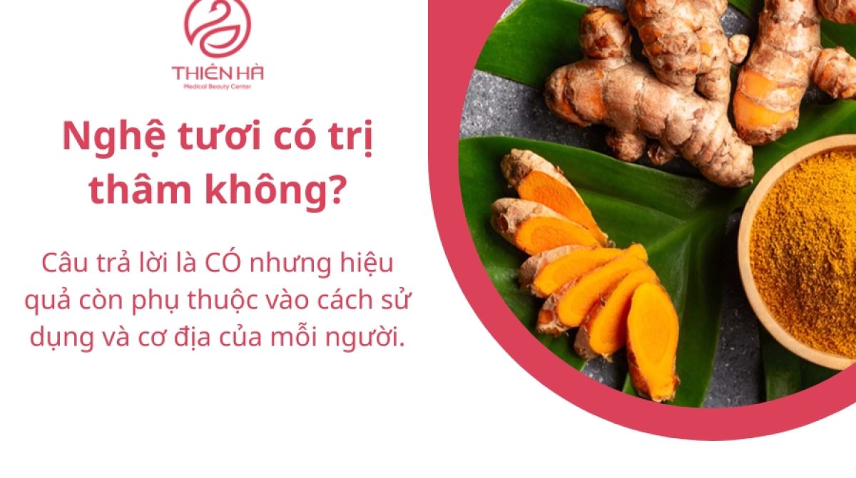 Bôi nghệ tươi bao lâu thì hết thâm? Giải pháp nào hiệu quả?