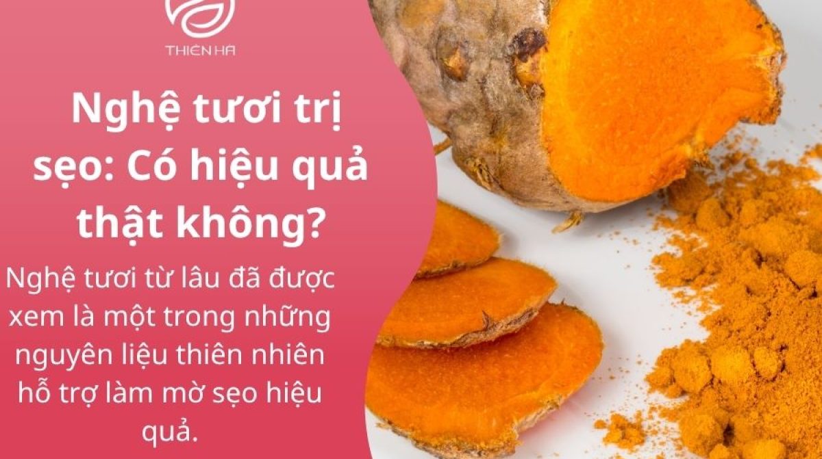 Cách Bôi Nghệ Tươi Trị Sẹo Hiệu Quả và An Toàn | Thiên Hà Spa
