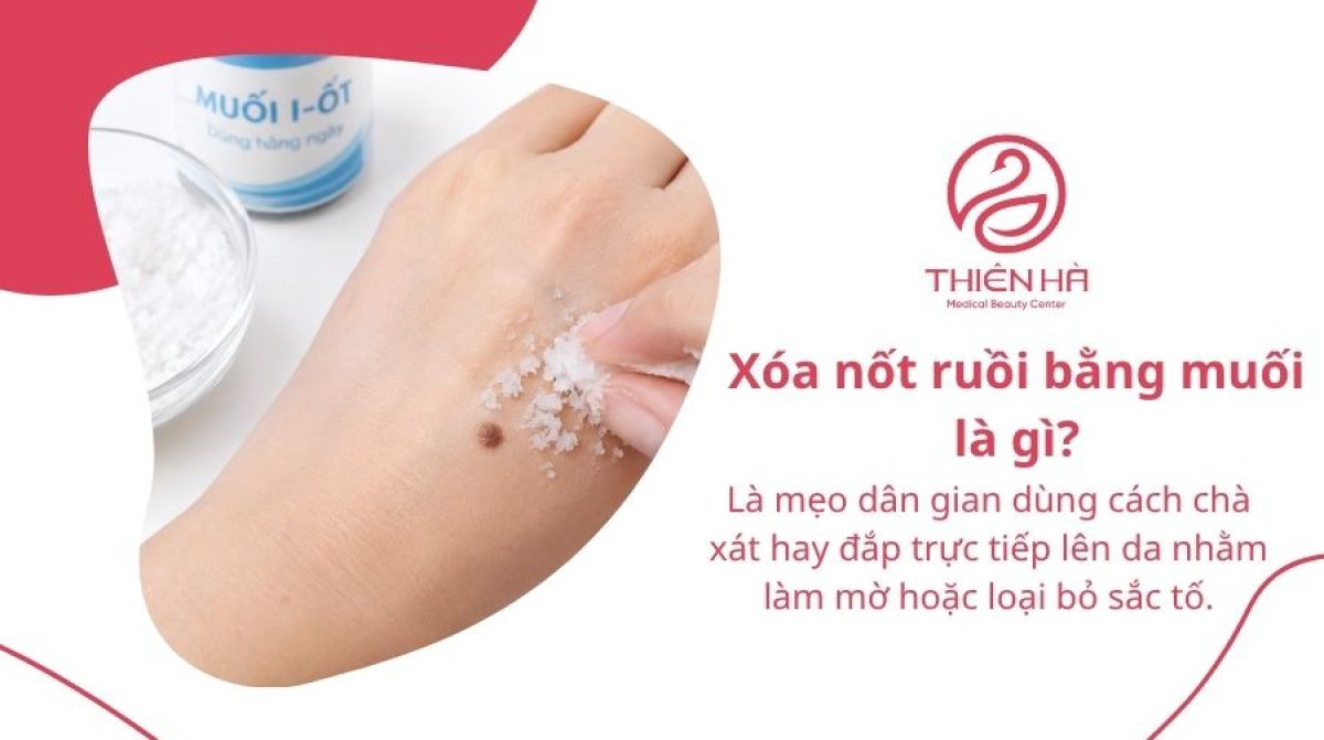 Cách xóa nốt ruồi bằng muối: Hướng dẫn và những rủi ro cần biết