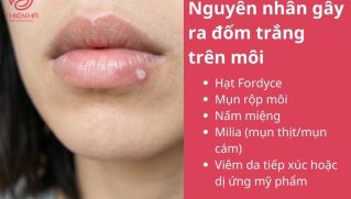 Cách chữa mụn trắng ở môi an toàn theo từng nguyên nhân