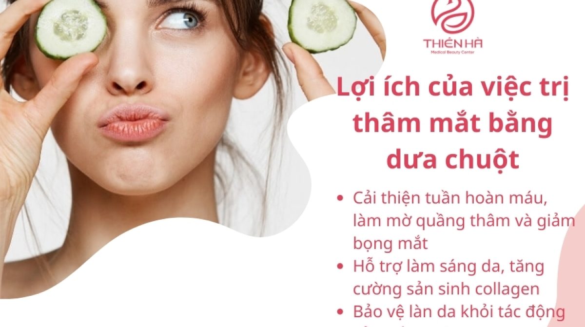 Cách đắp dưa leo trị thâm mắt hiệu quả nhất tại nhà 