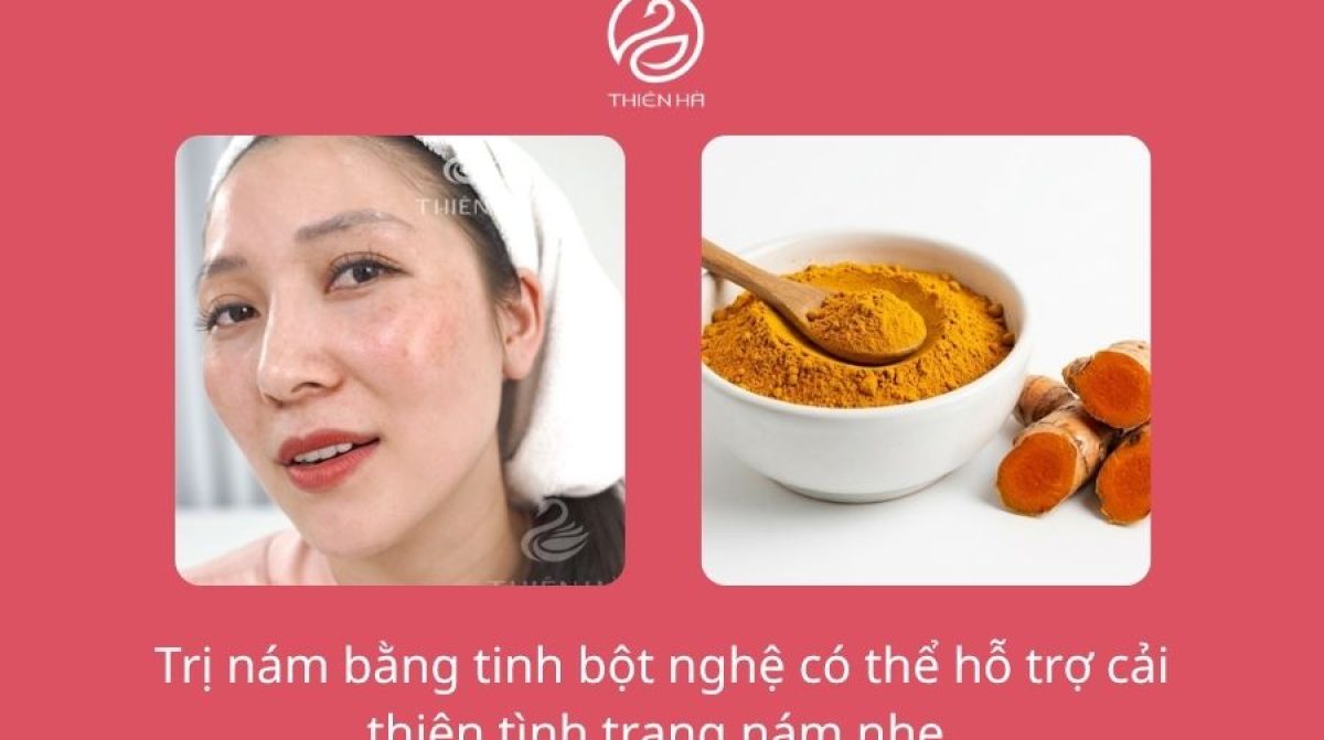 Cách đắp mặt nạ tinh bột nghệ trị nám hiệu quả tại nhà