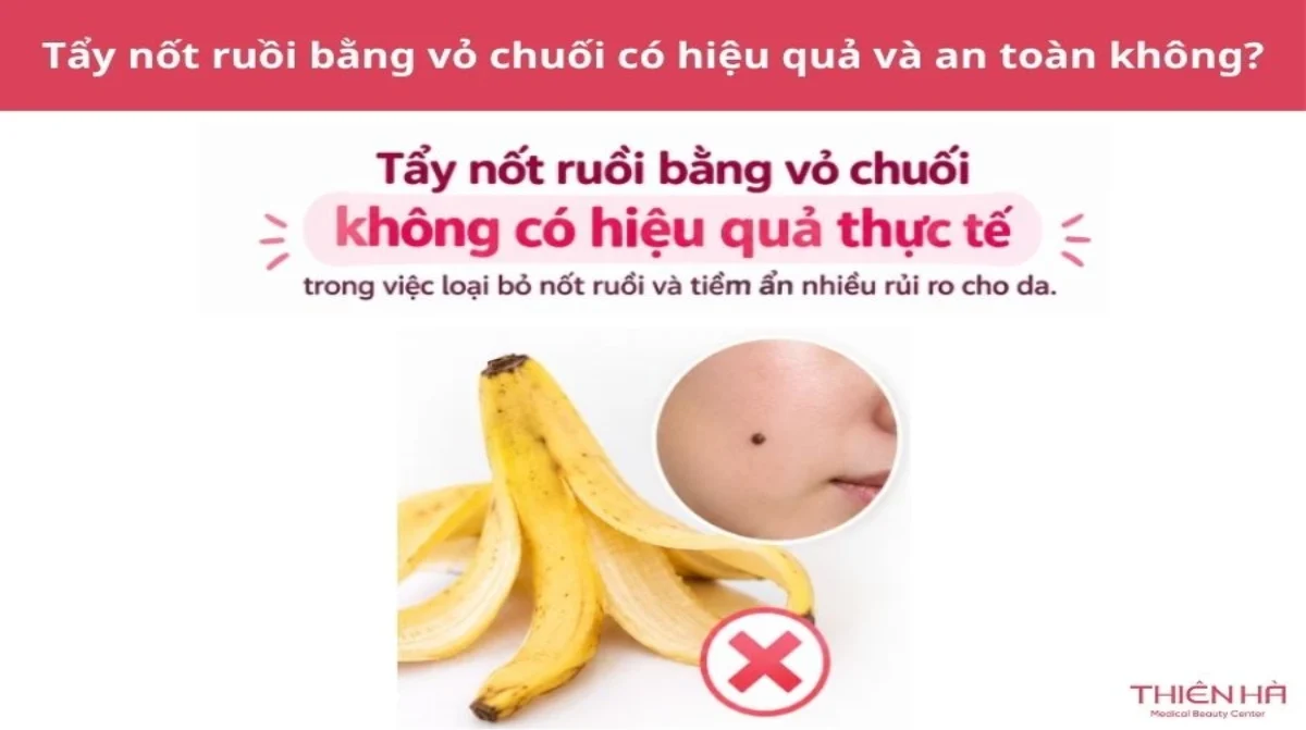 Cách tẩy nốt ruồi bằng vỏ chuối: Hiệu quả và cách thực hiện