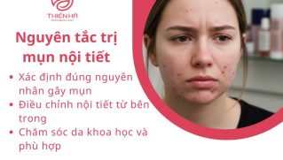 Cách trị mụn nội tiết hiệu quả: Chăm sóc da, thuốc và chế độ sống