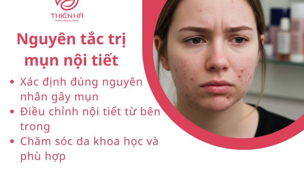 Cách trị mụn nội tiết hiệu quả: Chăm sóc da, thuốc và chế độ sống