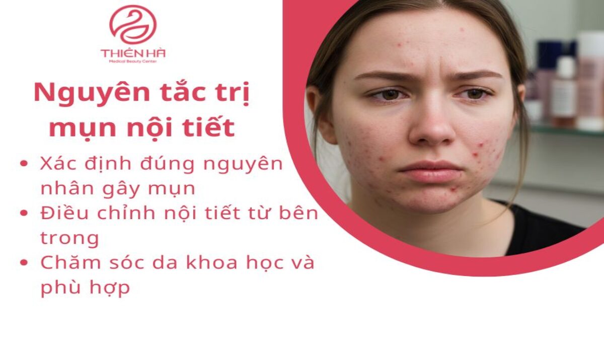 Cách trị mụn nội tiết hiệu quả: Chăm sóc da, thuốc và chế độ sống
