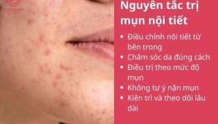 Cách trị mụn nội tiết dứt điểm: Kết hợp chăm sóc da và điều trị y khoa