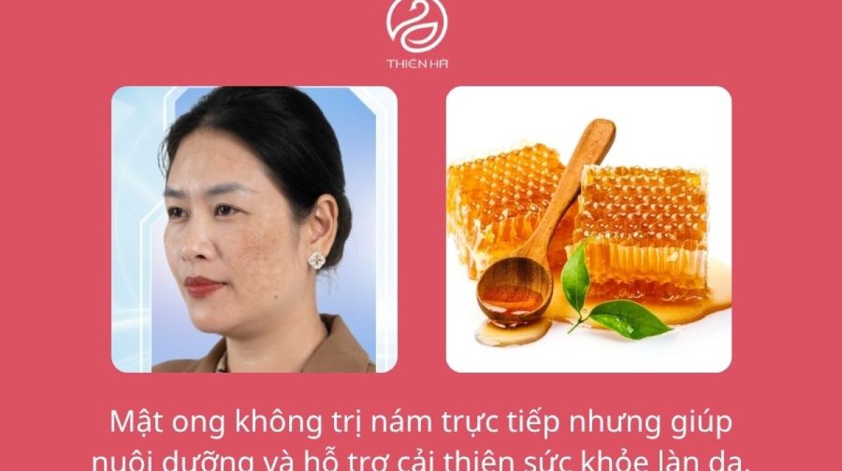 Bí quyết trị nám bằng mật ong giúp da sáng mịn, dễ áp dụng