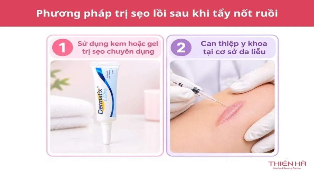 Cách trị sẹo sau khi tẩy nốt ruồi và chăm sóc da đúng cách