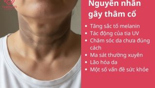 Cách trị thâm cổ nhanh nhất: bí quyết chăm sóc da tại nhà & spa