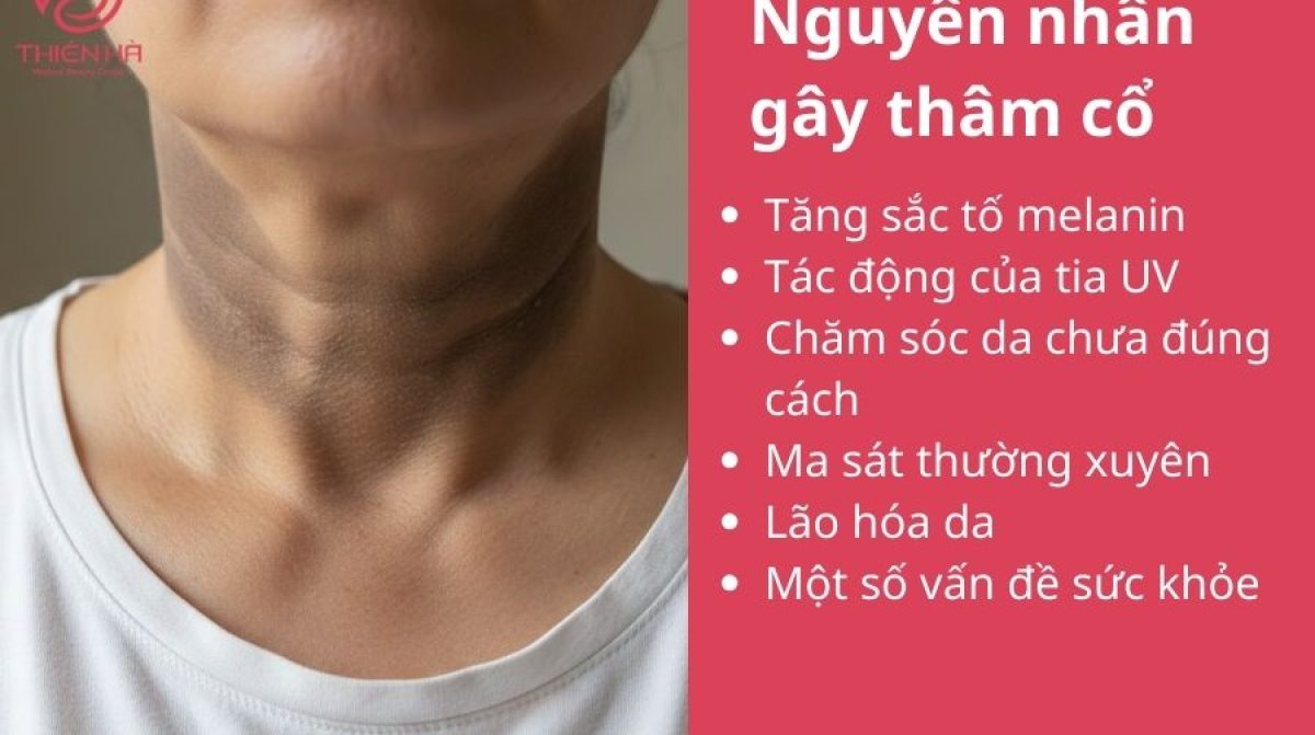 Cách trị thâm cổ nhanh nhất: bí quyết chăm sóc da tại nhà & spa