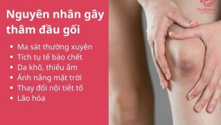 Tổng hợp cách trị thâm đầu gối an toàn từ tại nhà đến chuyên sâu