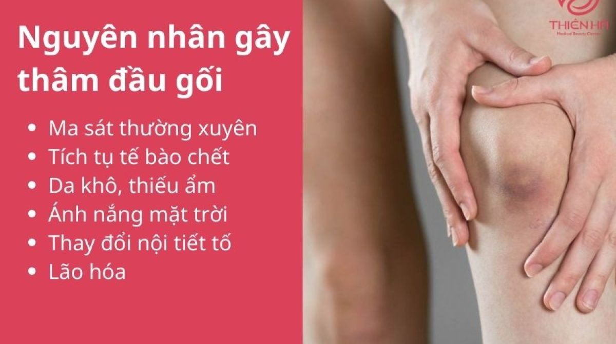 Tổng hợp cách trị thâm đầu gối an toàn từ tại nhà đến chuyên sâu
