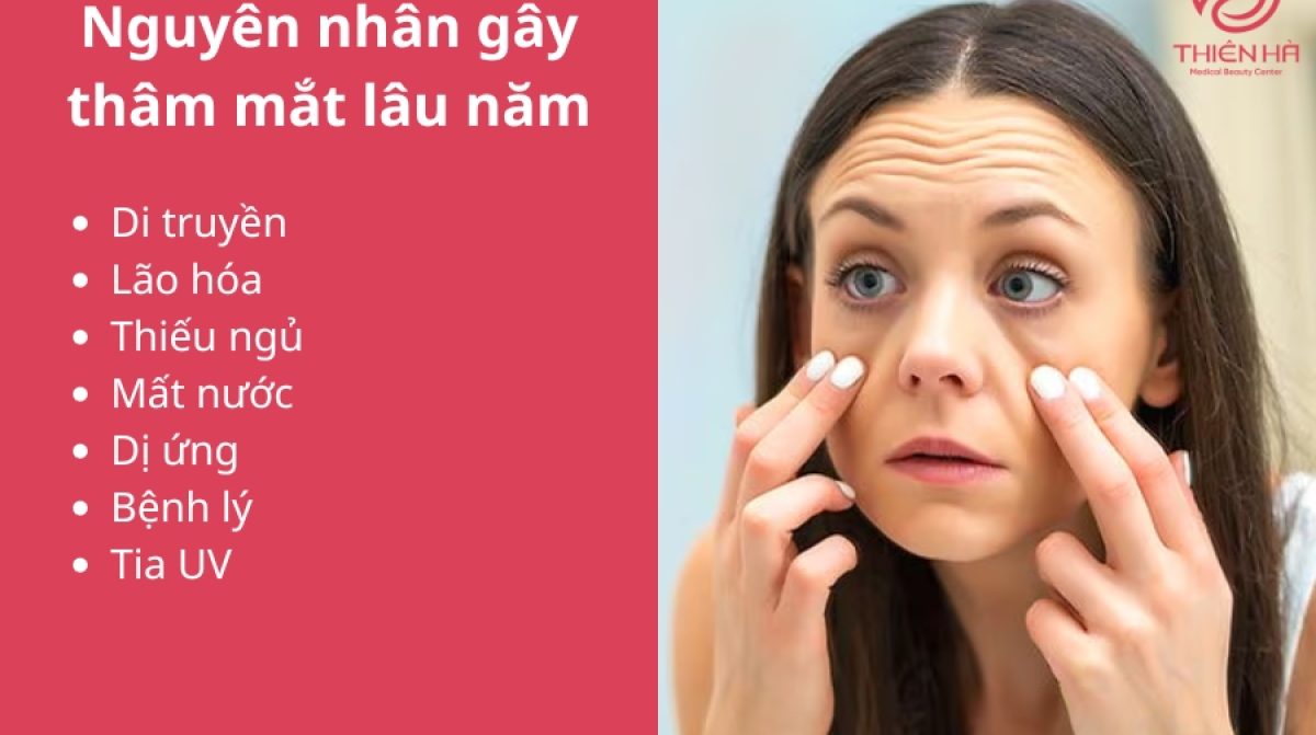 Cách trị thâm mắt lâu năm hiệu quả và an toàn tại Thiên Hà 