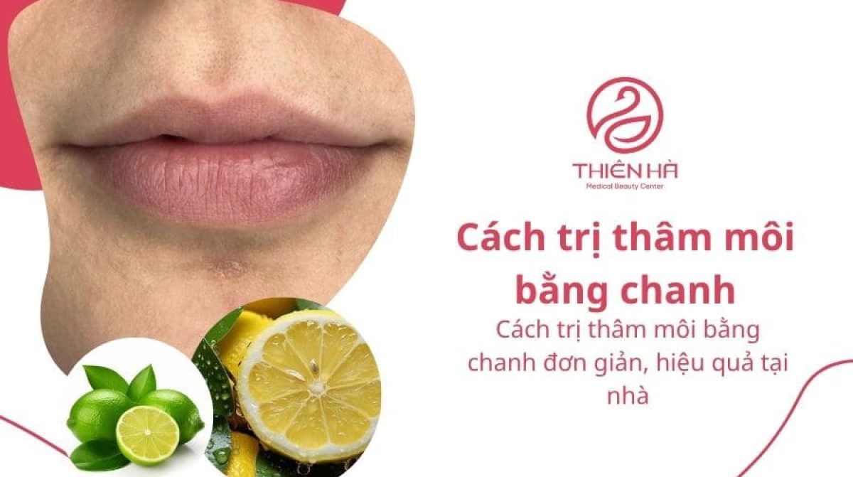 Cách trị thâm môi bằng chanh đơn giản, hiệu quả tại nhà