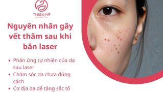 Cách trị vết thâm sau khi bắn laser giúp da phục hồi nhanh