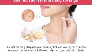Cách xóa nốt ruồi tại nhà bằng tỏi: Hướng dẫn và lưu ý an toàn