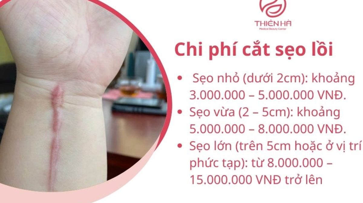Cắt Sẹo Lồi: Phương Pháp, Quy Trình Chuẩn Y Khoa & Chi Phí Điều Trị