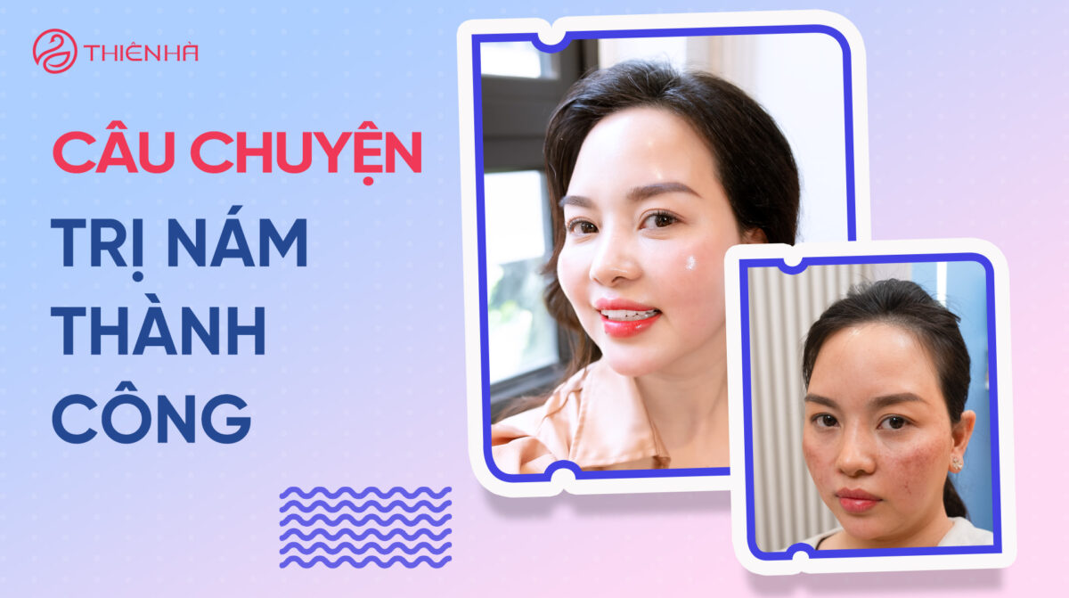Câu chuyện trị nám thành công: Từ nỗi lo đến làn da rạng rỡ