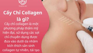 Cấy Chỉ Collagen: Lợi Ích, Quy Trình & Những Điều Cần Biết