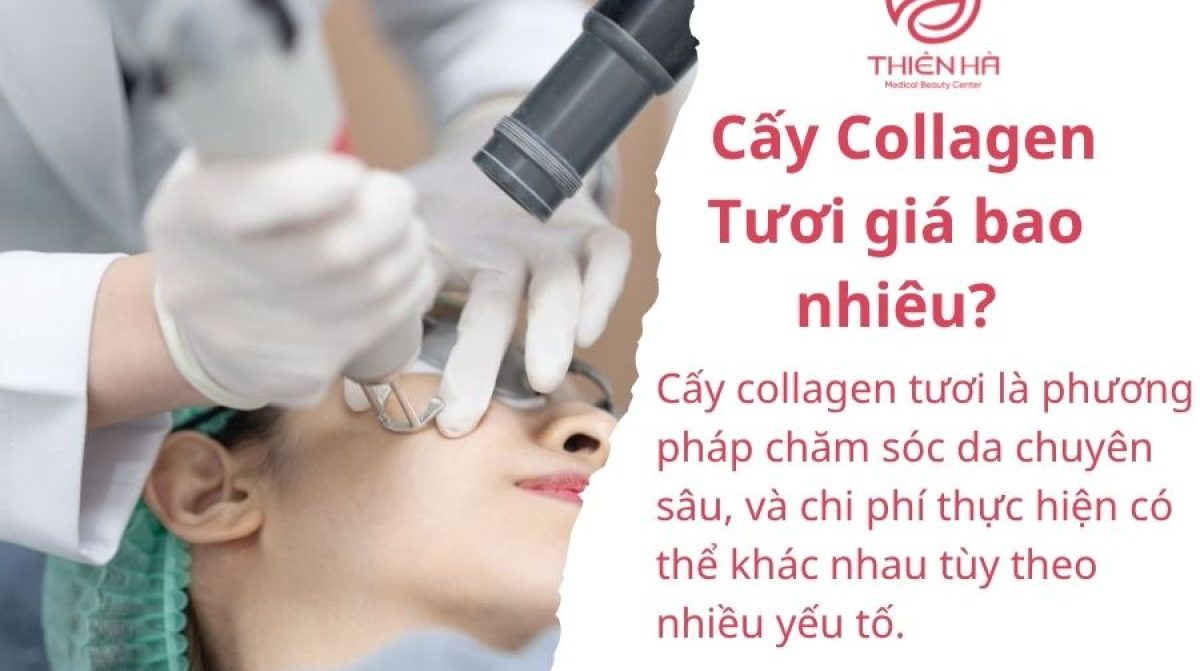 Cấy Collagen Tươi: Lợi Ích, Quy Trình & Địa Chỉ Uy Tín