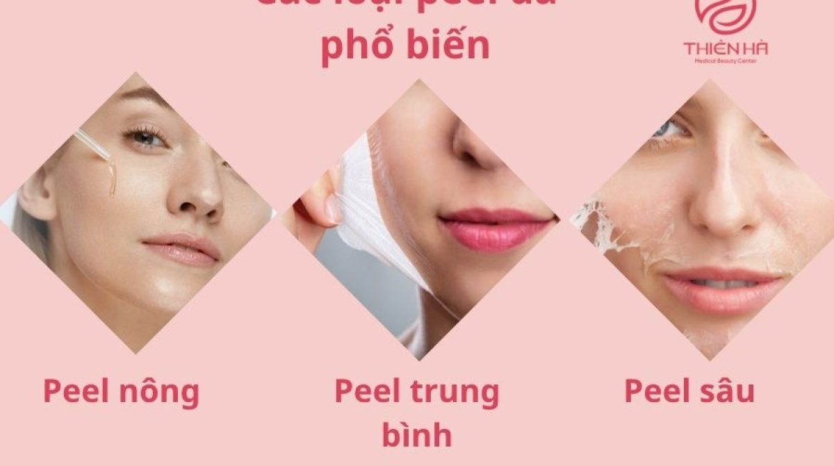 Có Bầu/Đang Cho Con Bú Có Peel Da Được Không? Lời Khuyên Từ Chuyên Gia