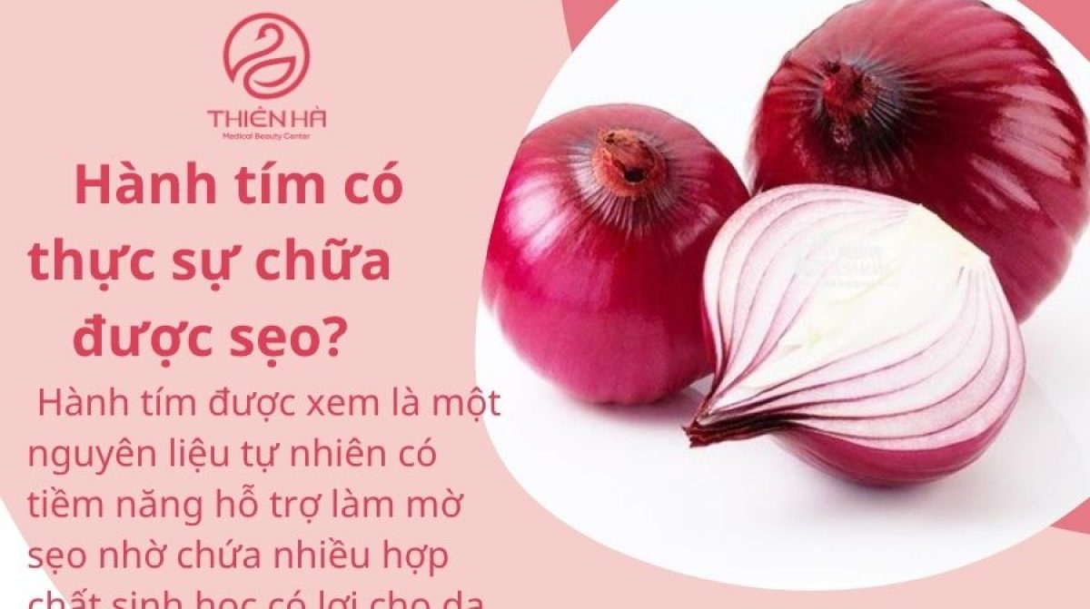 Chữa Sẹo Bằng Hành Tím: Hiệu Quả Thật Hay Chỉ Là Lời Đồn?