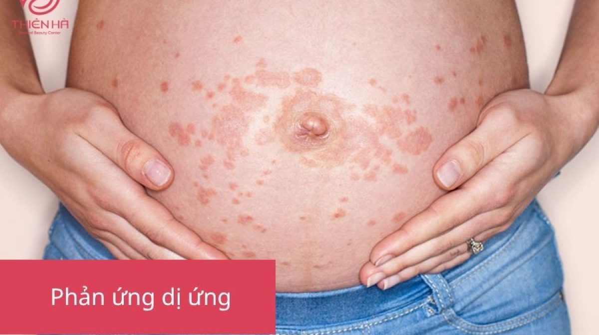 Có bầu tiêm filler được không? Lời khuyên từ chuyên gia