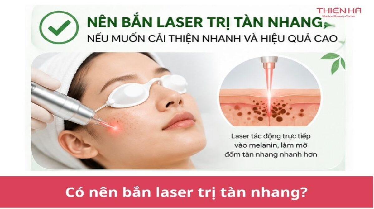 Có nên bắn laser trị tàn nhang? Ưu nhược điểm cần biết