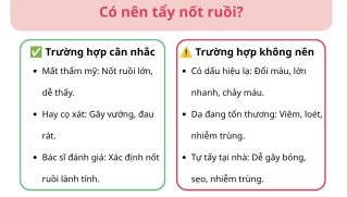 Có nên tẩy nốt ruồi không? Phương pháp an toàn và cách chăm sóc