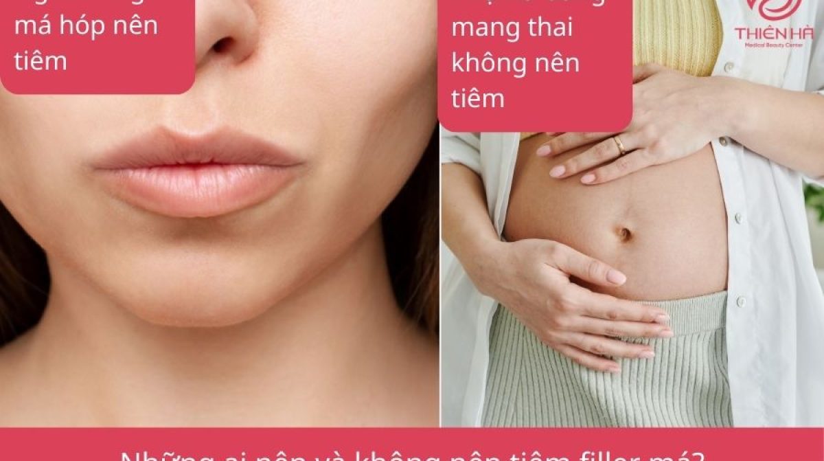 Có nên tiêm filler má không? Lợi ích, rủi ro và lưu ý quan trọng